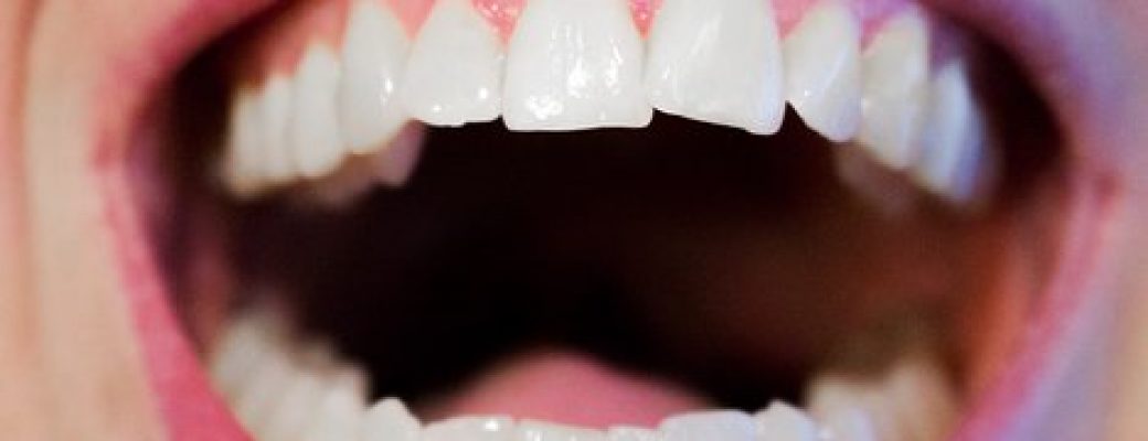 teeth-1652937__340